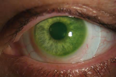 Scleral